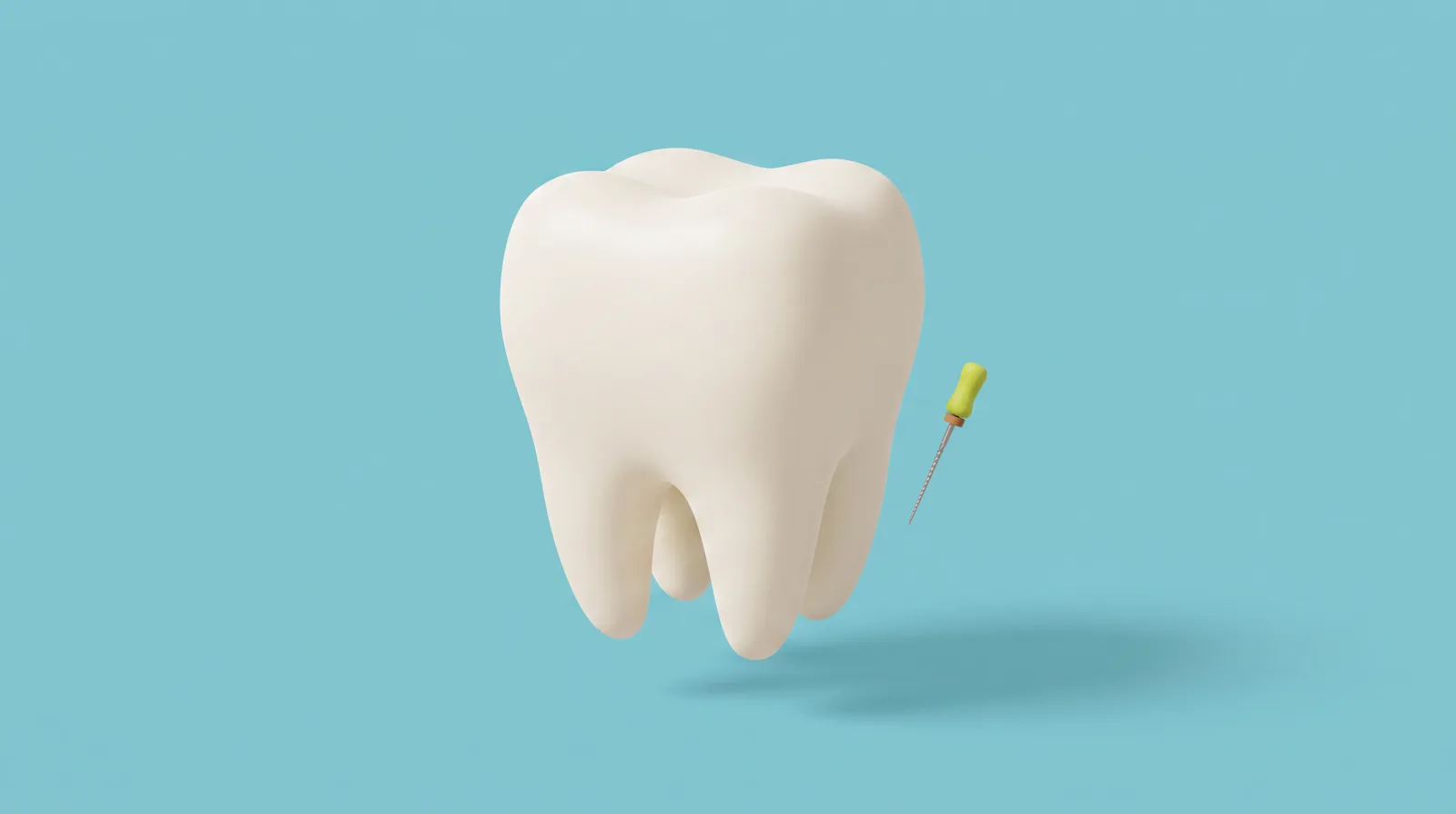 Ilustración de un molar grande junto a una lima de endodoncia muy pequeña