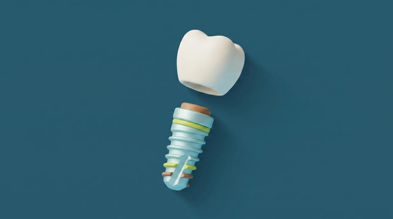Ilustración de una corona dental flotando sobre un tornillo de implante