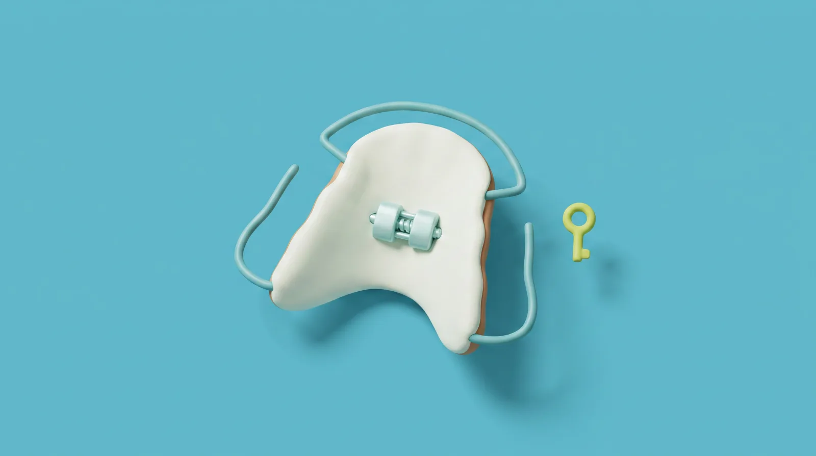 Ilustración de un expansor palatino infantil con su llave de activación